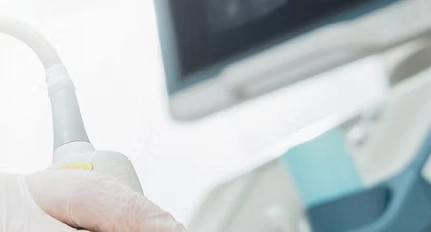 Ovulatory Dysfunction