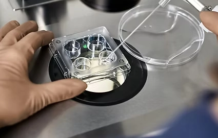 Uterine Fibroids & Infertility