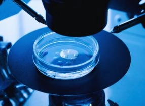 (IVM) نضوج البويضات خارج الجسم