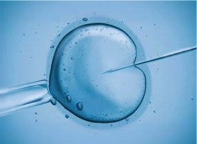 تحفيز الإباضة 